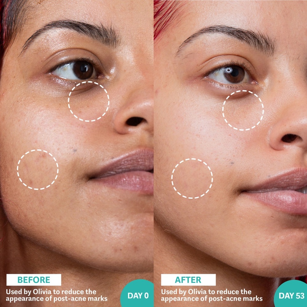 Selfless By Hyram Retinol & Rainbow Algae Repair Serum (x2) - Picture 2 of 4